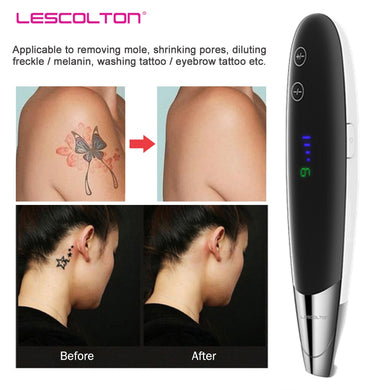 Tattoo Removal Machine Picosecond Laser Pen Mole Freckle Dark Spot Eyebrow Pigment Laser Machine