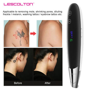 Tattoo Removal Machine Picosecond Laser Pen Mole Freckle Dark Spot Eyebrow Pigment Laser Machine